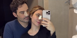 Fernando Zor e noiva fazerm cirurgia plástica juntos após reconciliação: ‘Felizes’