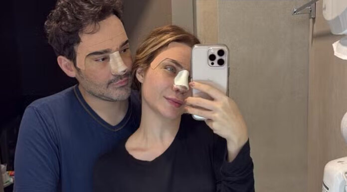 Fernando Zor e noiva fazerm cirurgia plástica juntos após reconciliação: ‘Felizes’