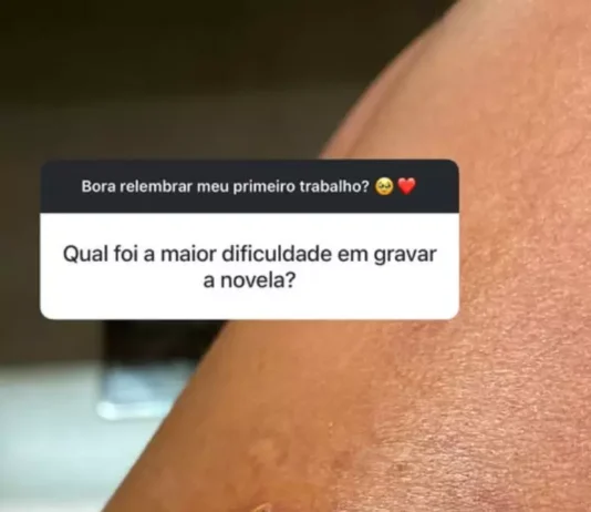 Bella Campos mostra mordida de jacaré ao dizer ‘maior dificuldade em gravar novela’; veja